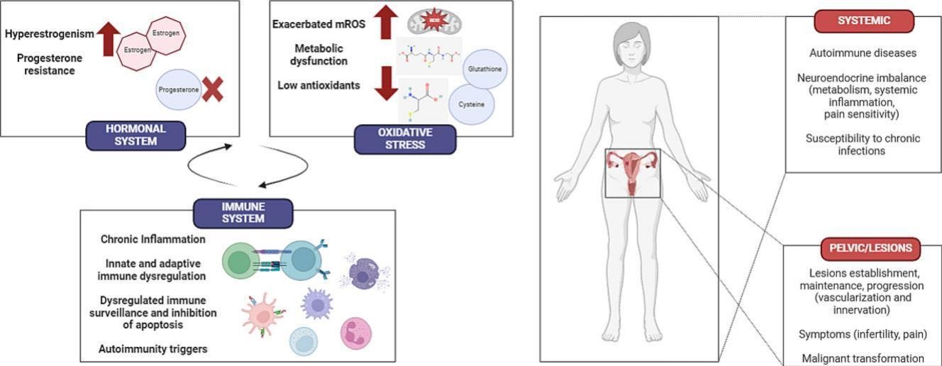 endometrioza endometrioza
